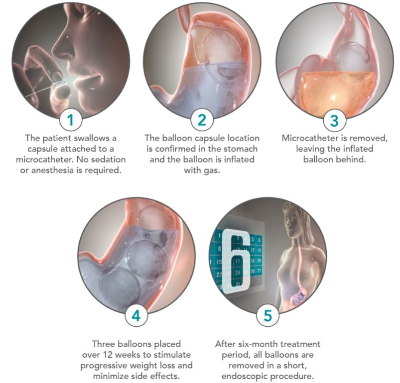 obalontreatmenta01.jpg